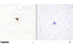 Immunohistochemistry analysis of paraffin-embedded human brain tissue using JAKMIP2 polyclonal antibody . (JAKMIP2 Antikörper  (C-Term))