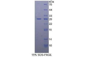 SDS-PAGE analysis of Mouse BCL2 Protein. (Bcl-2 Protein)