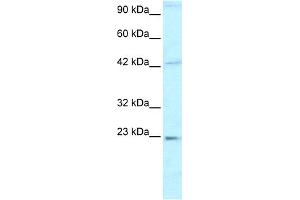 WB Suggested Anti-HMGB2 Antibody Titration:  0. (HMGB2 Antikörper  (C-Term))