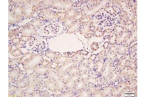 Formalin-fixed and paraffin embedded rat kidney labeled with Rabbit Anti-HER4/ErbB4 Polyclonal Antibody, Unconjugated  at 1:200 followed by conjugation to the secondary antibody and DAB staining (ERBB4 Antikörper  (AA 451-550))