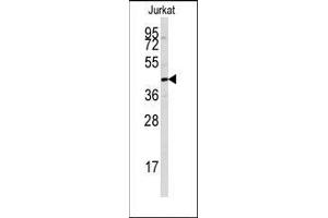 Western Blotting (WB) image for anti-Protein tyrosine Phosphatase, Non-Receptor Type 7 (PTPN7) (Ser44) antibody (ABIN359780)