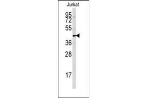 Western blot analysis of anti-PTPN7 Antibody in Jurkat cell line lysates (35ug/lane). (PTPN7 Antikörper  (Ser44))