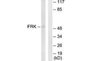 Western blot analysis of extracts from Jurkat cells, using FRK Antibody. (FRK Antikörper  (AA 71-120))