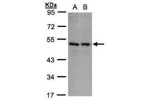 Western Blotting (WB) image for anti-Killer Cell Immunoglobulin-Like Receptor, three Domains, Long Cytoplasmic Tail, 1 (KIR3DL1) (Center) antibody (ABIN2854554)