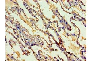 Immunohistochemistry of paraffin-embedded human lung tissue using ABIN7160405 at dilution of 1:100 (MYEF2 Antikörper  (AA 372-576))
