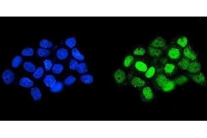 IF analysis of HOXD11 using anti-HOXD11 antibody (ABIN7603174). (HOXD11 Antikörper  (N-Term))