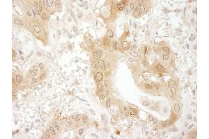 Immunohistochemistry (IHC) image for anti-Paxillin (PXN) (AA 1-50) antibody (ABIN7448716)