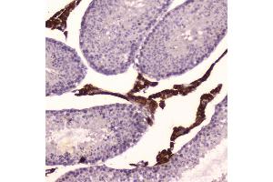 IHC analysis of Cyp17a1 using anti-Cyp17a1 antibody (ABIN5693094).