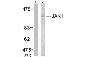 Western blot analysis of extracts from MCF7 cells using JAK1 (Ab-1022) antibody (E021119). (JAK1 Antikörper)
