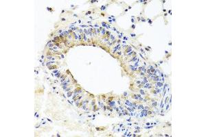 Immunohistochemistry of paraffin-embedded mouse lung using MUC16 antibody at dilution of 1:100 (x40 lens). (MUC16 Antikörper)