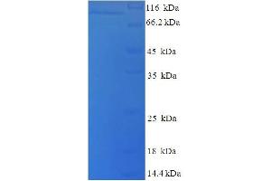SDS-PAGE (SDS) image for Lysyl Oxidase-Like 2 (LOXL2) (AA 26-776) protein (His tag) (ABIN5709873) (LOXL2 Protein (AA 26-776) (His tag))