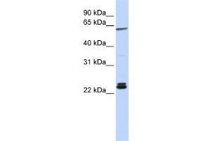 WB Suggested Anti-H1F0 Antibody Titration: 0. (Histone H1 Antikörper  (N-Term))