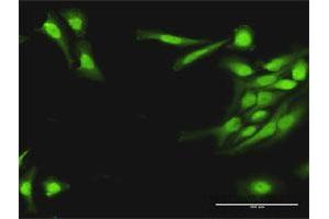 Immunofluorescence of purified MaxPab antibody to PLA2G16 on HeLa cell. (PLA2G16 Antikörper  (AA 1-162))