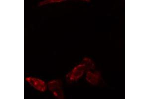 ABIN6274773 staining Hela cells by IF/ICC. (RPL23 Antikörper  (C-Term))