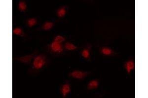 ABIN6274228 staining COLO205 cells by IF/ICC. (HOXA7 Antikörper  (Internal Region))