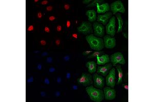 ABIN7093979 and ABIN7098023 staining Hela cells by IF/ICC. (RNASEH2C Antikörper  (Internal Region))