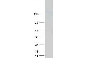 Western Blotting (WB) image for Nitric Oxide Synthase 2, Inducible (NOS2) protein (Myc-DYKDDDDK Tag) (ABIN2727470)