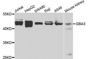 Western blot analysis of extracts of various cells, using GBA3 antibody. (GBA3 Antikörper)