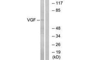 Western blot analysis of extracts from RAW264. (VGF Antikörper  (AA 454-503))