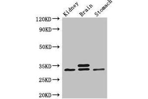 Western Blot Positive WB detected in: Mouse kidney tissue, Mouse brain tissue, Mouse stomach tissue All lanes: SCGN antibody at 3 μg/mL Secondary Goat polyclonal to rabbit IgG at 1/50000 dilution Predicted band size: 33 kDa Observed band size: 33 kDa (SCGN Antikörper  (AA 1-276))