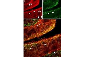 Expression of CNGA2 in rat cerebellum - Immunohistochemical staining of rat cerebellum using Anti-CNGA2 Antibody (ABIN7043090, ABIN7044955 and ABIN7044956). (CNGA2 Antikörper  (Intracellular))