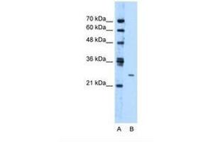 Image no. 1 for anti-Transmembrane Protein 126B (TMEM126B) (AA 141-190) antibody (ABIN321580) (TMEM126B Antikörper  (AA 141-190))
