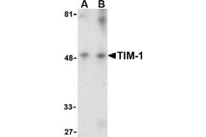 Western blot analysis of TIM-1 in human uterus tissue lysate with this product at (A) 1 and (B) 2 μg/ml.