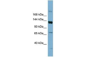 WB Suggested Anti-ABCB4 Antibody Titration:  0. (ABCB4 Antikörper  (Middle Region))