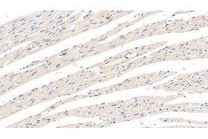 Detection of CRHBP in Rat Cardiac Muscle Tissue using Monoclonal Antibody to Corticotropin Releasing Hormone Binding Protein (CRHBP) (CRHBP Antikörper  (AA 25-322))