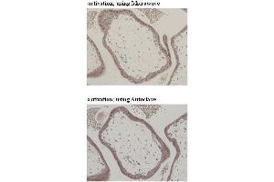 Immunohistochemistry (IHC) image for anti-CD274 (PD-L1) (Extracellular Domain) antibody (ABIN1449244)