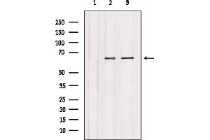 Western blot analysis of extracts from various samples, using CAF1B Antibody. (CHAF1B Antikörper  (N-Term))