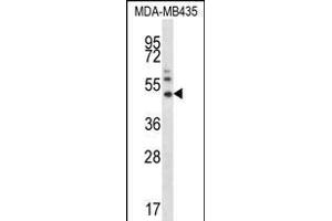 P16 Antibody  (ABIN390140 and ABIN2840644) western blot analysis in MDA-M cell line lysates (35 μg/lane). (MMP16 Antikörper  (N-Term))