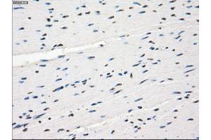 Image no. 5 for anti-Fc gamma RII (CD32) antibody (ABIN1497256) (Fc gamma RII (CD32) Antikörper)