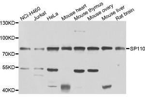 Western blot analysis of extracts of various cell lines, using SP110 antibody (ABIN5975571) at 1/1000 dilution. (SP110 Antikörper)