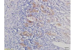 Immunohistochemistry (IHC) image for anti-SHC (Src Homology 2 Domain Containing) Transforming Protein 1 (SHC1) (AA 481-583) antibody (ABIN700990)