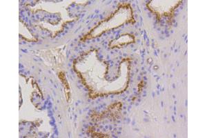 Paraformaldehyde-fixed, paraffin embedded mouse prostate, Antigen retrieval by boiling in sodium citrate buffer (pH6) for 15min, Block endogenous peroxidase by 3% hydrogen peroxide for 30 minutes, Blocking buffer at 37°C for 20min, Antibody incubation with Cytokeratin 17 (1B12) Monoclonal Antibody  at 1:50 overnight at 4°C, followed by a conjugated secondary and DAB staining. (KRT17 Antikörper)