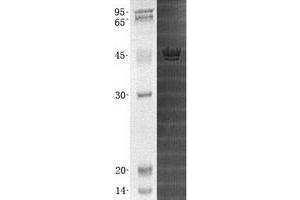 Western Blotting (WB) image for MAP3K12-Binding Inhibitory Protein 1 (MBIP) (Transcript Variant 2) protein (His tag) (ABIN2725579)