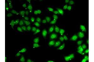 Immunofluorescence analysis of U2OS cells using AFF1 antibody. (AF4 Antikörper)