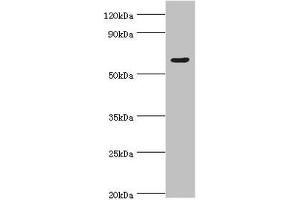 Western blot All lanes: TATA box-binding protein-associated factor RNA polymerase I subunit B antibody at 4 μg/mL + Hela whole cell lysate Secondary Goat polyclonal to rabbit IgG at 1/10000 dilution Predicted band size: 69, 61, 40 kDa Observed band size: 69 kDa (TAF1B Antikörper  (AA 369-588))