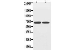 Anti-GLUT12 antibody, Western blotting Lane 1: PC-12 Cell Lysate Lane 2: A549 Cell Lysate (GLUT12 Antikörper  (Middle Region))