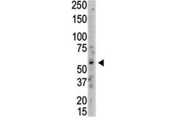 PRMT3 Antikörper  (AA 460-491)