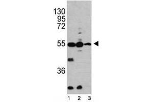 Western blot analysis of Caspase-2 antibody and 1) HL-60, 2) K562, 3) Ramos lysate.