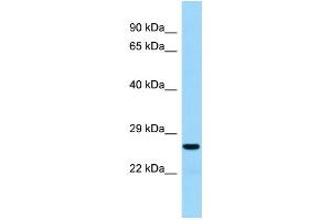 Host:  Rabbit  Target Name:  Akt1s1  Sample Type:  Rat Thymus lysates  Antibody Dilution:  1. (PRAS40 Antikörper  (Middle Region))