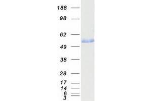 Western Blotting (WB) image for Aldehyde Dehydrogenase 3 Family, Member A1 (ALDH3A1) (Transcript Variant 2) protein (Myc-DYKDDDDK Tag) (ABIN2714542)