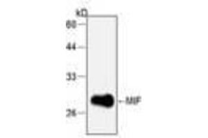 Image no. 1 for anti-Macrophage Migration Inhibitory Factor (Glycosylation-Inhibiting Factor) (MIF) antibody (ABIN791497) (MIF Antikörper)