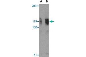 Western blot analysis of FYB in K-562 cell lysate with FYB polyclonal antibody  at (A) 0. (FYB Antikörper  (N-Term))