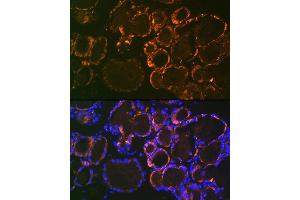 Immunofluorescence analysis of mouse thyroid using Parathyroid Hormone (PTH) (PTH) Rabbit mAb (ABIN7269175) at dilution of 1:100 (40x lens). (PTH Antikörper)