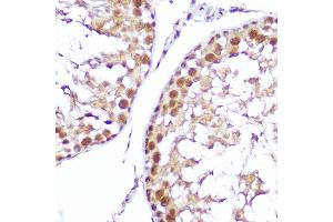 Immunohistochemistry of paraffin-embedded mouse testis using SMOX Rabbit pAb (ABIN6132875, ABIN6148142, ABIN6148143 and ABIN6215369) at dilution of 1:100 (40x lens). (SMOX Antikörper  (AA 1-200))