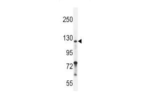 Neuropilin-2 Antibody (C-term ) (ABIN655525 and ABIN2845038) western blot analysis in ZR-75-1 cell line lysates (35 μg/lane). (NRP2 Antikörper  (C-Term))