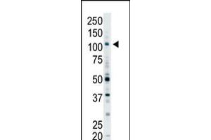 Antibody is used in Western blot to detect EPS15R in Y79 cell lysate. (EPS15 Antikörper  (N-Term))